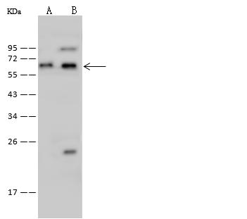 GLYR1 Antibody - Anti-GLYR1 rabbit polyclonal antibody at 1:500 dilution. Lane A: K562 Whole Cell Lysate. Lane B: Jurkat Whole Cell Lysate. Lysates/proteins at 30 ug per lane. Secondary: Goat Anti-Rabbit IgG (H+L)/HRP at 1/10000 dilution. Developed using the ECL technique. Performed under reducing conditions. Predicted band size: 61 kDa. Observed band size: 61 kDa.