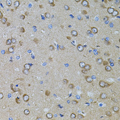 Gm13125 Antibody - Immunohistochemistry of paraffin-embedded rat brain using GM13125 antibody at dilution of 1:100 (40x lens).