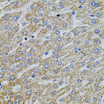 Gm13125 Antibody - Immunohistochemistry of paraffin-embedded human liver injury using GM13125 antibody at dilution of 1:100 (40x lens).