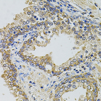 Gm13125 Antibody - Immunohistochemistry of paraffin-embedded human prostate using GM13125 antibody at dilution of 1:100 (40x lens).