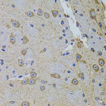 Gm13125 Antibody - Immunohistochemistry of paraffin-embedded mouse brain using GM13125 antibody at dilution of 1:100 (40x lens).
