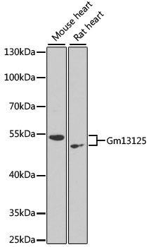 Gm13125 Antibody - Western blot analysis of extracts of various cell lines, using Gm13125 antibody at 1:1000 dilution. The secondary antibody used was an HRP Goat Anti-Rabbit IgG (H+L) at 1:10000 dilution. Lysates were loaded 25ug per lane and 3% nonfat dry milk in TBST was used for blocking. An ECL Kit was used for detection and the exposure time was 90s.