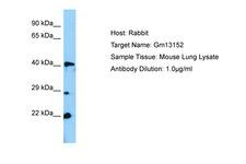 Gm13152 Antibody -  This image was taken for the unconjugated form of this product. Other forms have not been tested.
