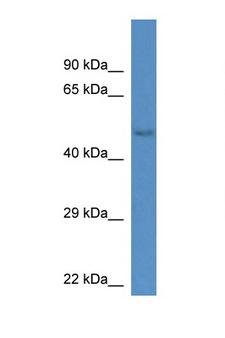 Gm13178 Antibody - GM13178 antibody Western blot of Mouse Kidney lysate. Antibody concentration 1 ug/ml. This image was taken for the unconjugated form of this product. Other forms have not been tested.