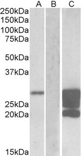 GM2A Antibody - HEK293 lysate (10ug protein in RIPA buffer) overexpressing Human GM2A with DYKDDDDK tag probed with (1.0ug/ml) in Lane A and probed with anti- DYKDDDDK Tag (1/30000) in lane C. Mock-transfected HEK293 probed (1mg/ml) in Lane B. Primar