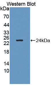 GM2A Antibody - Western blot of GM2A antibody.