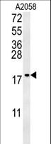 GM2A Antibody - GM2A Antibody western blot of A2058 cell line lysates (35 ug/lane). The GM2A antibody detected the GM2A protein (arrow).