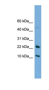 GM2A Antibody - GM2A antibody Western blot of HeLa lysate. This image was taken for the unconjugated form of this product. Other forms have not been tested.