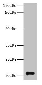 GM2A Antibody - Western blot All lanes: Ganglioside GM2 activator antibody at 2µg/ml + Rat kidney tissue Secondary Goat polyclonal to rabbit IgG at 1/10000 dilution Predicted band size: 21 kDa Observed band size: 21 kDa