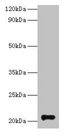 GM2A Antibody - Western blot All lanes: Ganglioside GM2 activator antibody at 2µg/ml + Rat kidney tissue Secondary Goat polyclonal to rabbit IgG at 1/10000 dilution Predicted band size: 21 kDa Observed band size: 21 kDa