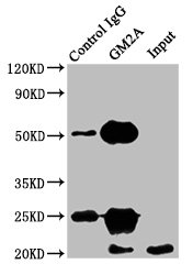 GM2A Antibody - Immunoprecipitating GM2A in HEK293 whole cell lysate Lane 1: Rabbit control IgG instead of GM2A Antibody in HEK293 whole cell lysate.For western blotting, a HRP-conjugated Protein G antibody was used as the secondary antibody (1/2000) Lane 2: GM2A Antibody (8µg) + HEK293 whole cell lysate (500µg) Lane 3: HEK293 whole cell lysate (10µg)