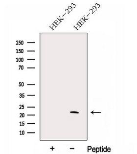 GM2A Antibody - Western blot analysis of extracts of HEK293 cells using GM2A antibody. The lane on the left was treated with blocking peptide.