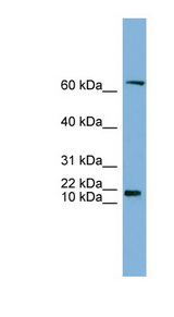 GM2A Antibody - GM2A antibody Western blot of HT1080 cell lysate. This image was taken for the unconjugated form of this product. Other forms have not been tested.