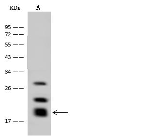 GM2A Antibody - Anti-GM2A rabbit polyclonal antibody at 1:500 dilution. Lane A: HeLa Whole Cell Lysate. Lysates/proteins at 30 ug per lane. Secondary: Goat Anti-Rabbit IgG (H+L)/HRP at 1/10000 dilution. Developed using the ECL technique. Performed under reducing conditions. Predicted band size: 21 kDa. Observed band size: 21 kDa. (We are unsure as to the identity of these extra bands.)