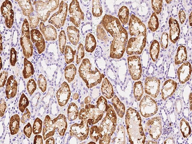 GM2A Antibody - GM2A was immunoprecipitated using: Lane A: 0.5 mg HeLa Whole Cell Lysate. 4 uL anti-GM2A rabbit polyclonal antibody and 60 ug of Immunomagnetic beads Protein A/G. Primary antibody: Anti-GM2A rabbit polyclonal antibody, at 1:100 dilution. Secondary antibody: Goat Anti-Rabbit IgG (H+L)/HRP at 1/10000 dilution. Developed using the ECL technique. Performed under reducing conditions. Predicted band size: 21 kDa. Observed band size: 21 kDa.