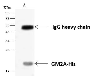 GM2A Antibody - Immunochemical staining of human GM2A in human kidney with rabbit polyclonal antibody at 1:1000 dilution, formalin-fixed paraffin embedded sections.