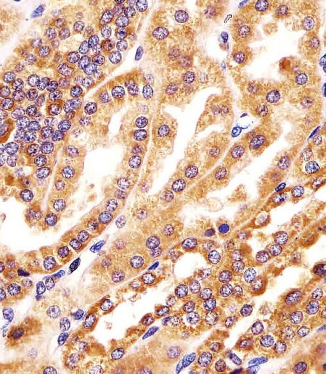 GMCL1 Antibody - Antibody staining GMCL1 in human kidney tissue sections by Immunohistochemistry (IHC-P - paraformaldehyde-fixed, paraffin-embedded sections). Tissue was fixed with formaldehyde and blocked with 3% BSA for 0. 5 hour at room temperature; antigen retrieval was by heat mediation with a citrate buffer (pH 6). Samples were incubated with primary antibody (1:25) for 1 hours at 37°C. A undiluted biotinylated goat polyvalent antibody was used as the secondary antibody.