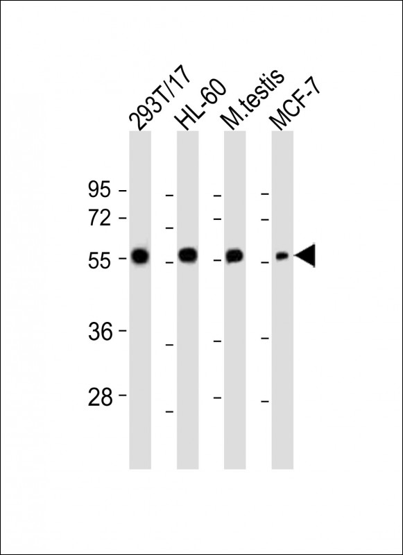 GMCL1 Antibody - All lanes: Anti-GMCL1 Antibody (Center) at 1:2000 dilution. Lane 1: 293T/17 whole cell lysate. Lane 2: HL-60 whole cell lysate. Lane 3: mouse testis lysate. Lane 4: MCF-7 whole cell lysate Lysates/proteins at 20 ug per lane. Secondary Goat Anti-Rabbit IgG, (H+L), Peroxidase conjugated at 1:10000 dilution. Predicted band size: 59 kDa. Blocking/Dilution buffer: 5% NFDM/TBST.