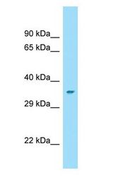 GMDS / GMD Antibody - GMDS / GMD antibody Western Blot of Human heart.  This image was taken for the unconjugated form of this product. Other forms have not been tested.