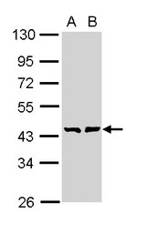 GMDS / GMD Antibody - Sample (30 ug of whole cell lysate). A: A431 , B: H1299. 10% SDS PAGE. GMDS / GMD antibody diluted at 1:1000.