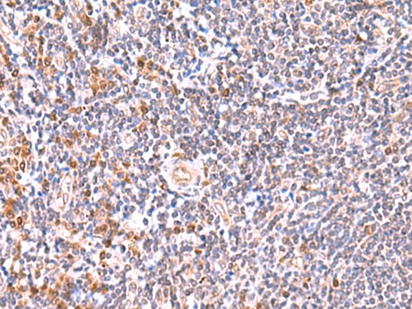 GMDS / GMD Antibody - Immunohistochemistry of paraffin-embedded Human tonsil tissue  using GMDS Polyclonal Antibody at dilution of 1:55(×200)