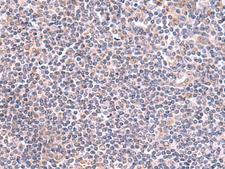 GMDS / GMD Antibody - Immunohistochemistry of paraffin-embedded Human tonsil tissue  using GMDS Polyclonal Antibody at dilution of 1:70(×200)