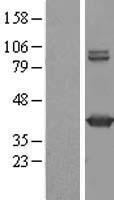 GMDS / GMD Protein - Western validation with an anti-DDK antibody * L: Control HEK293 lysate R: Over-expression lysate