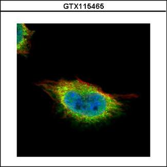 GMEB1 Antibody - Confocal immunofluorescence analysis (Olympus FV10i) of paraformaldehyde-fixed HeLa, using GMEB1 antibody (Green) at 1:500 dilution. Alpha-tubulin filaments were labeled with alpha-tubulin antibody (Red) at 1:2000.