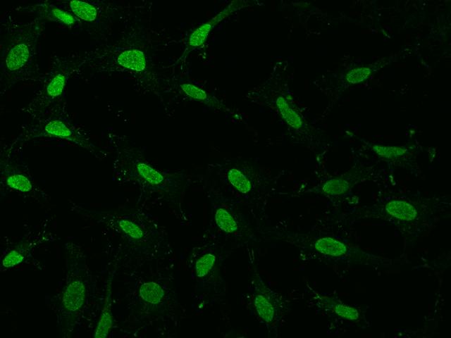 GMEB1 Antibody - Immunofluorescence staining of GMEB1 in Hela cells. Cells were fixed with 4% PFA, permeabilzed with 0.1% Triton X-100 in PBS, blocked with 10% serum, and incubated with rabbit anti-human GMEB1 polyclonal antibody (dilution ratio 1:1000) at 4°C overnight. Then cells were stained with the Alexa Fluor 488-conjugated Goat Anti-rabbit IgG secondary antibody (green). Positive staining was localized to Nucleus.