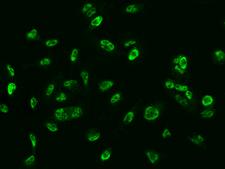 GMEB1 Antibody - Immunofluorescence staining of GMEB1 in U251MG cells. Cells were fixed with 4% PFA, permeabilzed with 0.3% Triton X-100 in PBS, blocked with 10% serum, and incubated with rabbit anti-Human GMEB1 polyclonal antibody (dilution ratio 1:200) at 4°C overnight. Then cells were stained with the Alexa Fluor 488-conjugated Goat Anti-rabbit IgG secondary antibody (green).