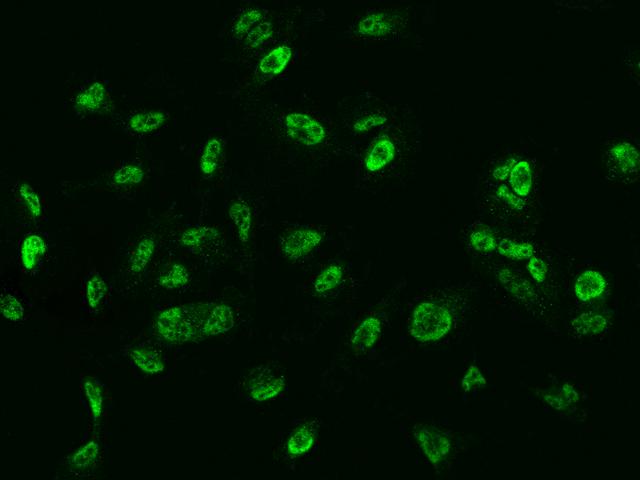 GMEB1 Antibody - Immunofluorescence staining of GMEB1 in U251MG cells. Cells were fixed with 4% PFA, permeabilzed with 0.3% Triton X-100 in PBS, blocked with 10% serum, and incubated with rabbit anti-Human GMEB1 polyclonal antibody (dilution ratio 1:200) at 4°C overnight. Then cells were stained with the Alexa Fluor 488-conjugated Goat Anti-rabbit IgG secondary antibody (green).