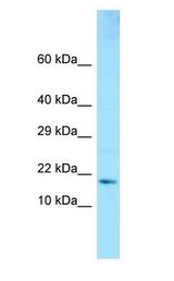 GMF Beta / GMFB Antibody - GMF Beta / GMFB antibody Western Blot of Fetal Brain.  This image was taken for the unconjugated form of this product. Other forms have not been tested.