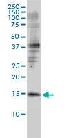 GMF Beta / GMFB Antibody - GMFB monoclonal antibody (M01), clone 2G12-2A2 Western Blot analysis of GMFB expression in Jurkat.