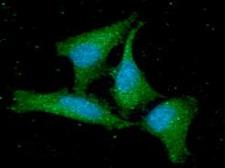 GMF Beta / GMFB Antibody - ICC/IF analysis of GMFB in HeLa cells line, stained with DAPI (Blue) for nucleus staining and monoclonal anti-human GMFB antibody (1:100) with goat anti-mouse IgG-Alexa fluor 488 conjugate (Green).
