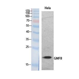 GMF Beta / GMFB Antibody - Western Blot analysis of extracts from HeLa cells using GMFB Antibody.