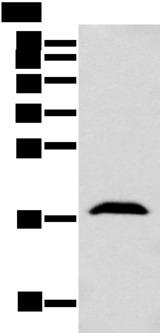 GMF Beta / GMFB Antibody - Western blot analysis of Mouse brain tissue  using GMFB Polyclonal Antibody at dilution of 1:250