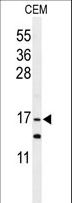 GMFG Antibody - Western blot of GMFG Antibody in CEM cell line lysates (35 ug/lane). GMFG (arrow) was detected using the purified antibody.