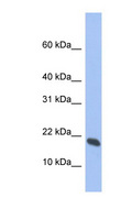 GMFG Antibody - GMFG antibody Western blot of Fetal Thymus lysate. This image was taken for the unconjugated form of this product. Other forms have not been tested.