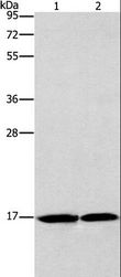 GMFG Antibody - Western blot analysis of Mouse heart and human fetal brain tissue, using GMFG Polyclonal Antibody at dilution of 1:1142.