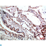 GMFG Antibody - Immunohistochemical analysis of paraffin-embedded human-lung, antibody was diluted at 1:200.