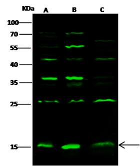 GMFG Antibody - Anti-GMFB rabbit polyclonal antibody at 1:500 dilution. Lane A: HepG2 Whole Cell Lysate. Lane B: Jurkat Whole Cell Lysate. Lane C: Raji Whole Cell Lysate. Lysates/proteins at 30 ug per lane. Secondary: Goat Anti-Rabbit IgG H&L (Dylight800) at 1/10000 dilution. Developed using the Odyssey technique. Performed under reducing conditions. Predicted band size: 17 kDa. Observed band size: 17 kDa. (We are unsure as to the identity of these extra bands.)