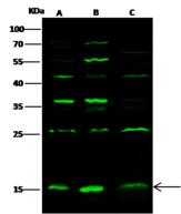 GMFG Antibody - Anti-GMFB rabbit polyclonal antibody at 1:500 dilution. Lane A: HepG2 Whole Cell Lysate. Lane B: Jurkat Whole Cell Lysate. Lane C: Raji Whole Cell Lysate. Lysates/proteins at 30 ug per lane. Secondary: Goat Anti-Rabbit IgG H&L (Dylight800) at 1/10000 dilution. Developed using the Odyssey technique. Performed under reducing conditions. Predicted band size: 17 kDa. Observed band size: 17 kDa. (We are unsure as to the identity of these extra bands.)