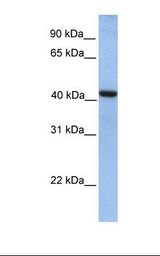 GMPPA Antibody - Fetal lung lysate. Antibody concentration: 1.0 ug/ml. Gel concentration: 12%.  This image was taken for the unconjugated form of this product. Other forms have not been tested.