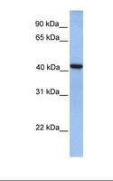 GMPPA Antibody - Fetal lung lysate. Antibody concentration: 1.0 ug/ml. Gel concentration: 12%.  This image was taken for the unconjugated form of this product. Other forms have not been tested.