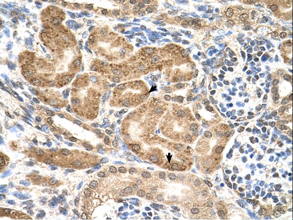 GMPPB Antibody - GMPPB antibody GMPPB(GDP-mannose pyrophosphorylase B) Antibody was used in IHC to stain formalin-fixed, paraffin-embedded human kidney.  This image was taken for the unconjugated form of this product. Other forms have not been tested.