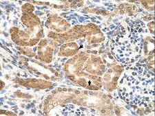 GMPPB Antibody - GMPPB antibody GMPPB(GDP-mannose pyrophosphorylase B) Antibody was used in IHC to stain formalin-fixed, paraffin-embedded human kidney.  This image was taken for the unconjugated form of this product. Other forms have not been tested.