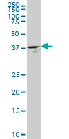 GMPPB Antibody - GMPPB monoclonal antibody (M07), clone 2B5 Western blot of GMPPB expression in HepG2.
