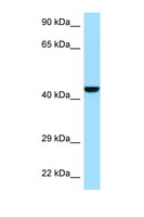 GMPPB Antibody - GMPPB antibody Western blot of Mouse Pancreas lysate. Antibody concentration 1 ug/ml.  This image was taken for the unconjugated form of this product. Other forms have not been tested.