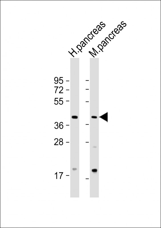 GMPPB Antibody - All lanes: Anti-GMPPB Antibody (N-Term) at 1:2000 dilution Lane 1: human pancreas lysate Lane 2: mouse pancreas lysate Lysates/proteins at 20 µg per lane. Secondary Goat Anti-Rabbit IgG, (H+L), Peroxidase conjugated at 1/10000 dilution. Predicted band size: 40 kDa Blocking/Dilution buffer: 5% NFDM/TBST.