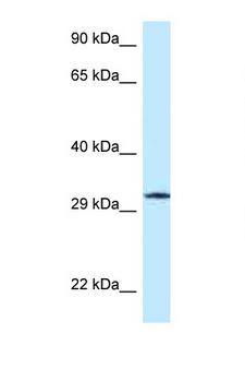 GMPR1 / GMPR Antibody - GMPR / GMPR1 antibody Western blot of Jurkat Cell lysate. Antibody concentration 1 ug/ml.  This image was taken for the unconjugated form of this product. Other forms have not been tested.